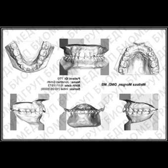 Программное обеспечение для стоматологических лабoраторий Ortho Insight 3D Full / Lite