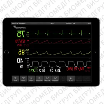 Приложение iOS для медицинской симуляции TruMonitor