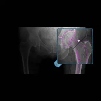 Медицинское программное обеспечение OrthoView