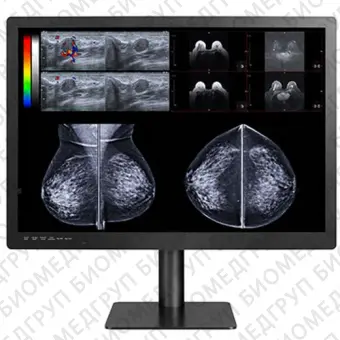 Double Black Imaging Gemini Series 12 MP Large Format Display Медицинский монитор