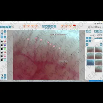 Капилляроскоп видео DM03