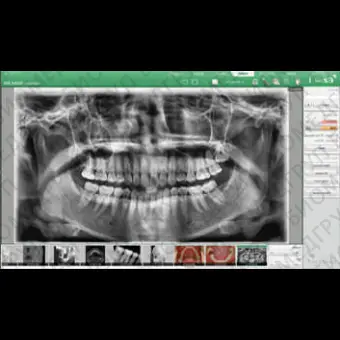 Программное обеспечение для обработки снимков зубов EzDenti