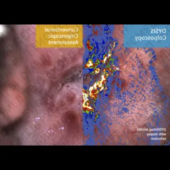 Медицинское программное обеспечение DYSISmap
