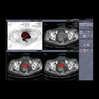 Программное обеспечение для медицинских снимков Xelis Fusion