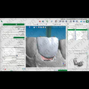 Программное обеспечение для стоматологии Straumann CARES