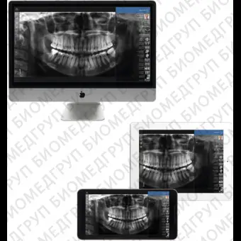 Приложение iOS для обработки снимков зубов Planmeca mRomexis Mobile