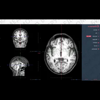 Программное обеспечение для МРТ Brainance MD