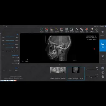 Программное обеспечение для обработки снимков зубов SmartV Pro