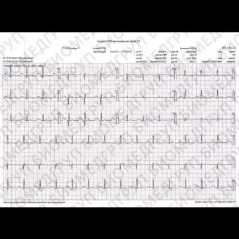 Электрокардиограф для спокойного состояния PE1201