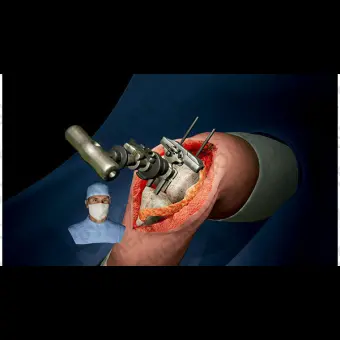 Медицинский симулятор для ортопедической хирургии SimOrtho