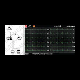 Электрокардиограф для спокойного состояния Cardipia 800 H smart