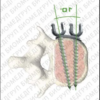 Пластина скоба XIA anterior, с двумя отверстиями, каудальная, средняя