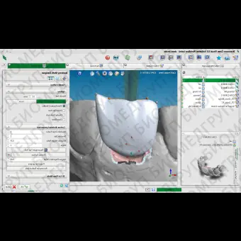 Программное обеспечение для стоматологии Straumann CARES