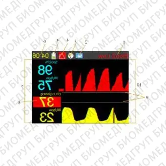 Монитор пациента CO2 Capnoxi