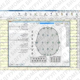 ЭЭГсистема 32 канала NEURONSPECTRUM5