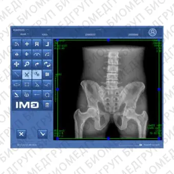 Программное обеспечение для медицинских снимков DXRay