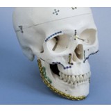 Компрессионная костная пластина для челюстно-лицевого восстановления Optimus Mandible System