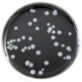 Среда ростовая BCYE для изоляции Legionella, чашки Петри 90 мм, 10 шт/уп, Thermo FS, PO5072A